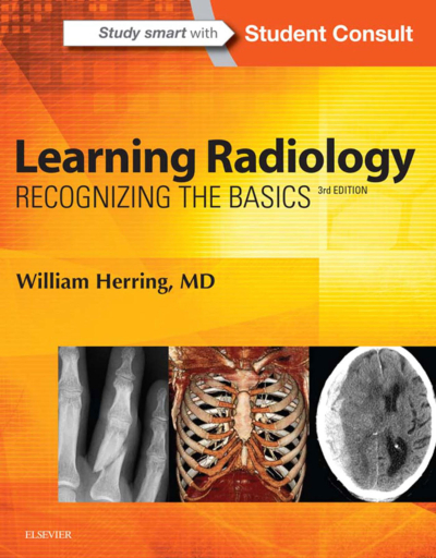 Learning Radiology: Recognizing The Basics / William Herring FotokoPink